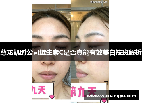 尊龙凯时公司维生素C是否真能有效美白祛斑解析